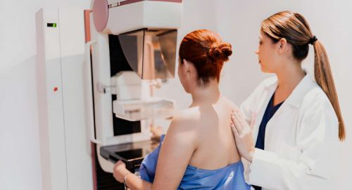 Tumore al seno, ProteinTalks apre la strada alla cellula virtuale